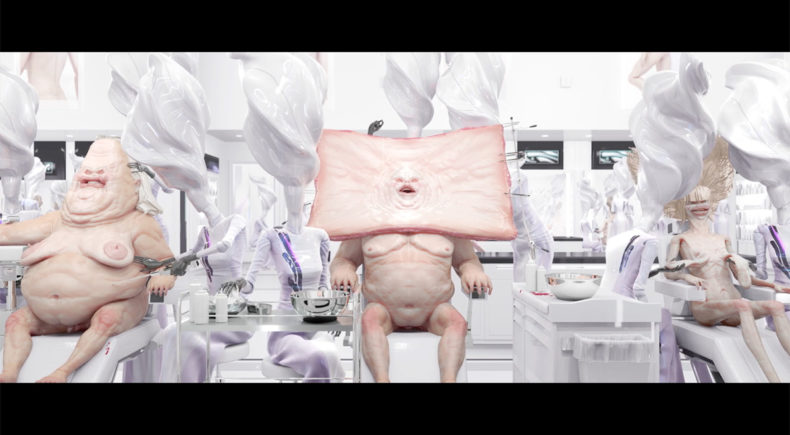 Caterpillarplasty - still #5