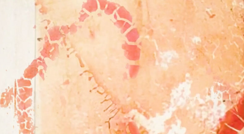 Menorrhagia - still #1